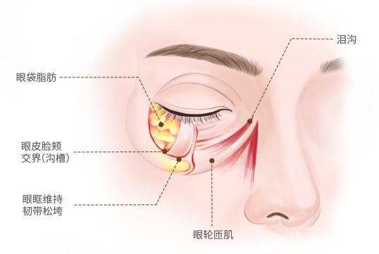然衰老的标志去除眼袋焕发青春光彩j9九游会真人游戏第一眼袋不是自(图1)